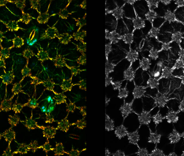 © PicoQuant: Image of comparison of maximum intensity and FLIM images